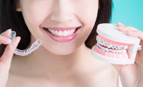 Invisalign Benefits, Victoria Dentist